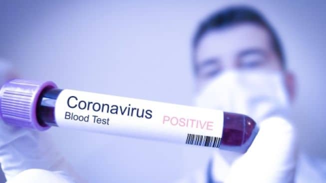 Coronavirus