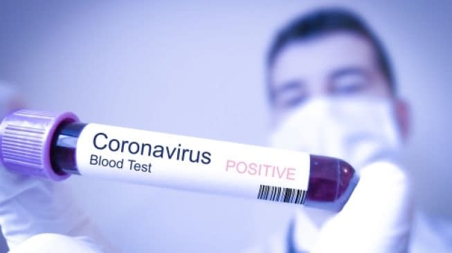 Coronavirus